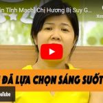 chi huong - suy gian tinh mach