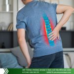 Có những tiêu chí nào đánh giá bệnh động kinh đã được chữa khỏi?